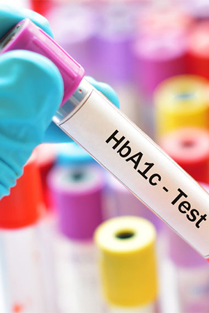 A1C Test