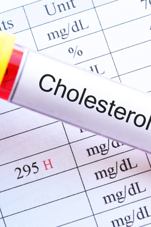 Cholesterol Test