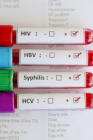 STD Test